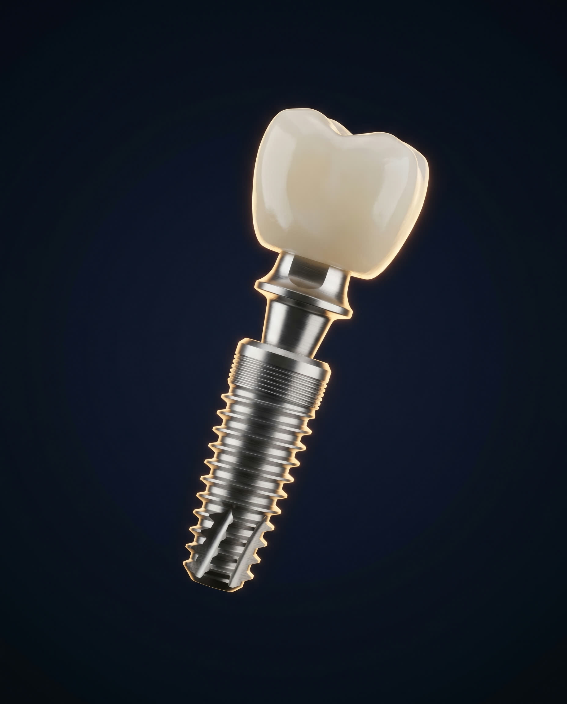 Representação tridimensional de um implante dentário com coroa cerâmica